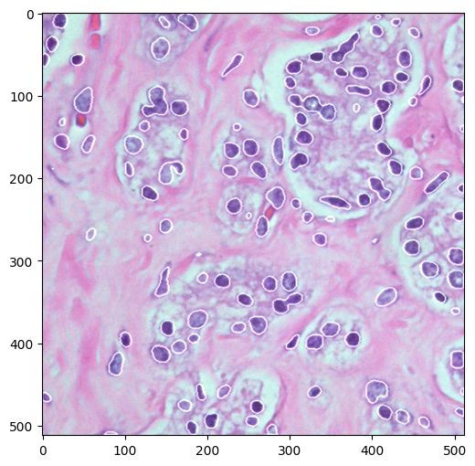 Segmentation 2